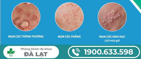 Hình ảnh minh họa